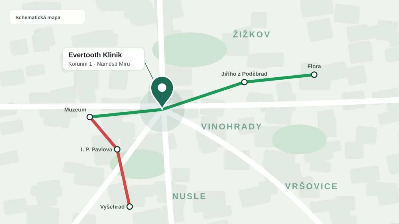 Schematická mapa okolí Náměstí Míru s ordinací Evertooth Klinik