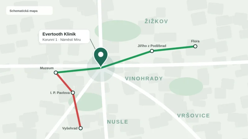 Schematická mapa okolí Náměstí Míru s ordinací Evertooth Klinik